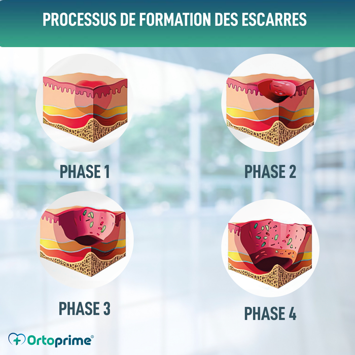 Coussin Antiescarres Viscoélastique pour Coccyx 60kg/m3
