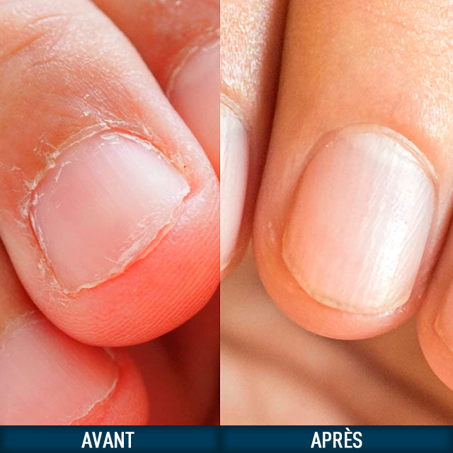 Vernis Anti-Morsure pour Ongles au Goût Amer